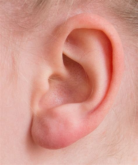Wie man verstopfte Ohren los wird